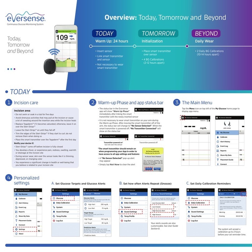 eversense CGM Sensor user guide