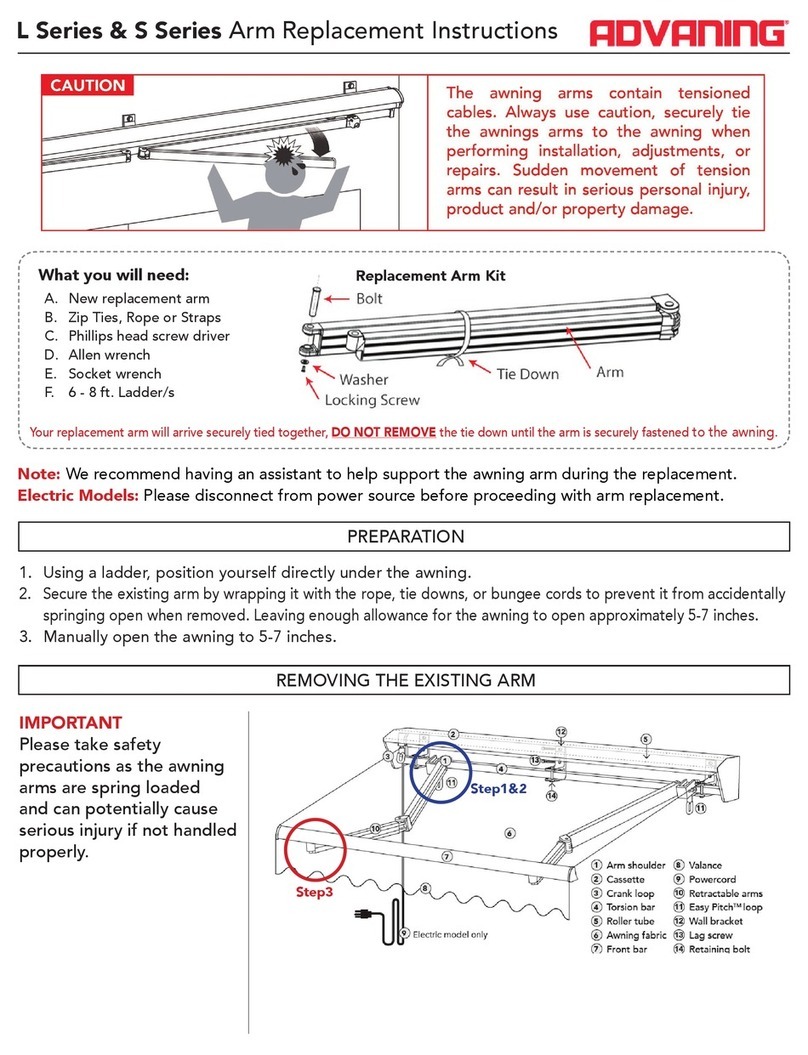 Advaning S series Replacement instructions
