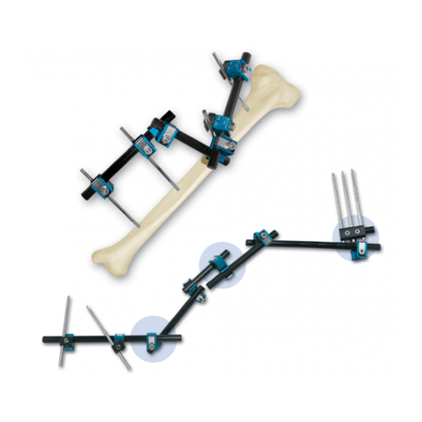 Orthofix PREFIX 2 manual