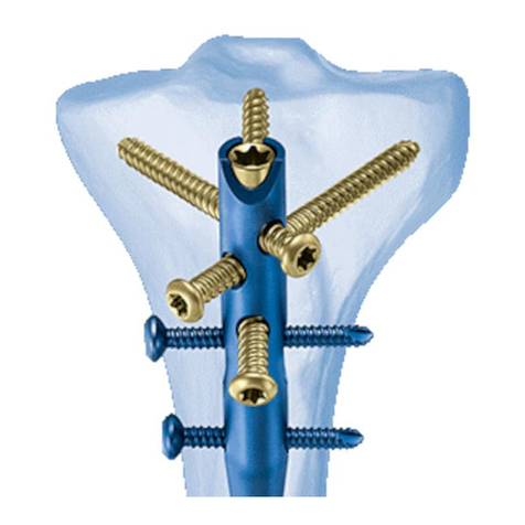 Synthes Expert Tibial Nail User manual Synthes Expert Tibial Nail User manual
