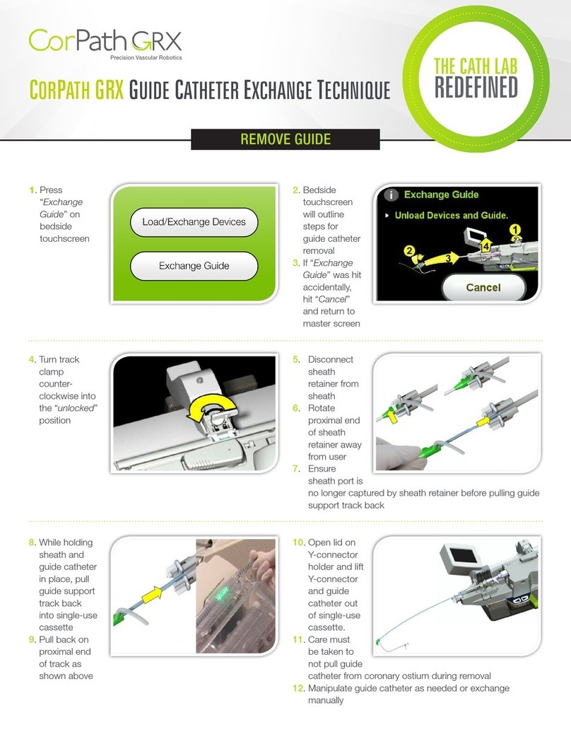 Corindus CorPath GRX Remove Guide
