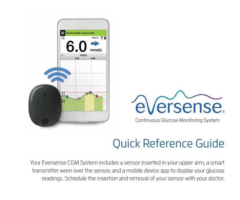senseonics eversense Quick reference guide