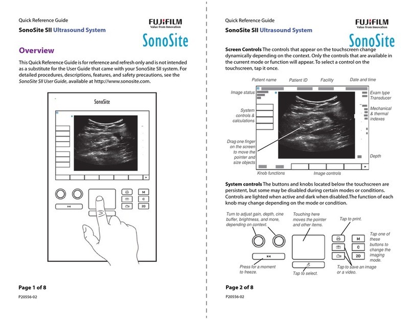 FujiFilm SonoSite SII Quick reference guide