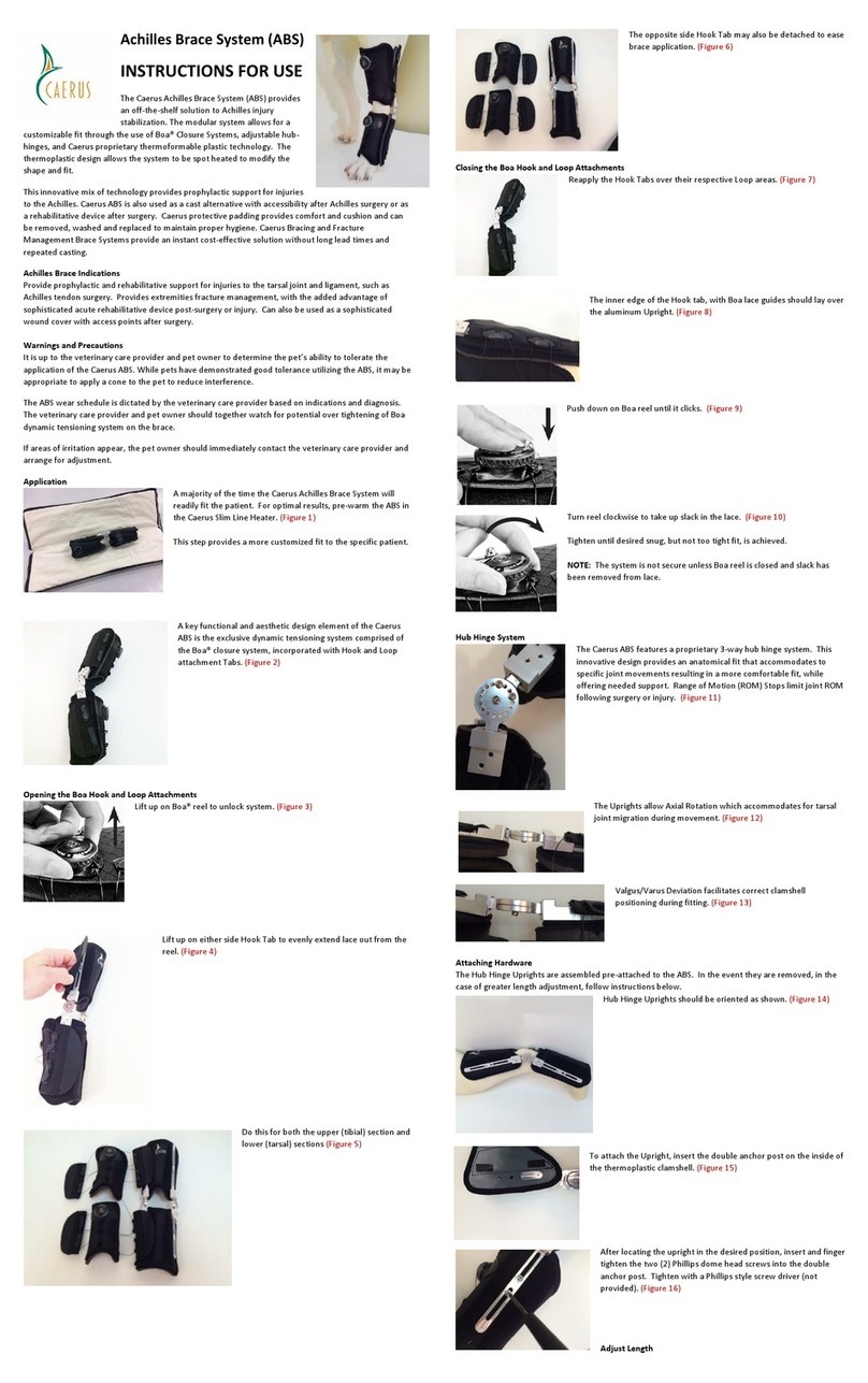 Caerus Achilles Brace System User manual