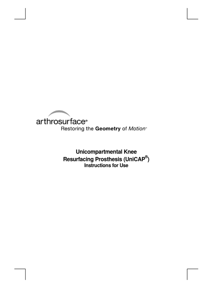 arthrosurface Unicap Instructions for use arthrosurface Unicap Instructions for use