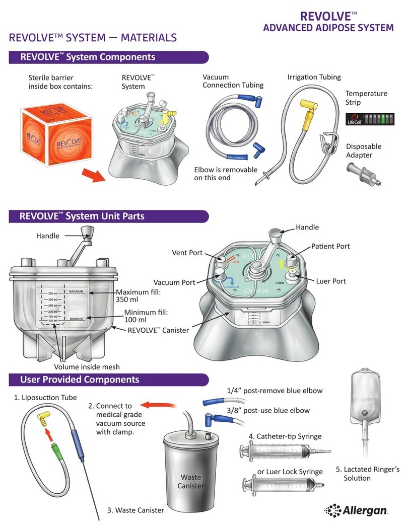 Allergan REVOLVE System Instructions for use