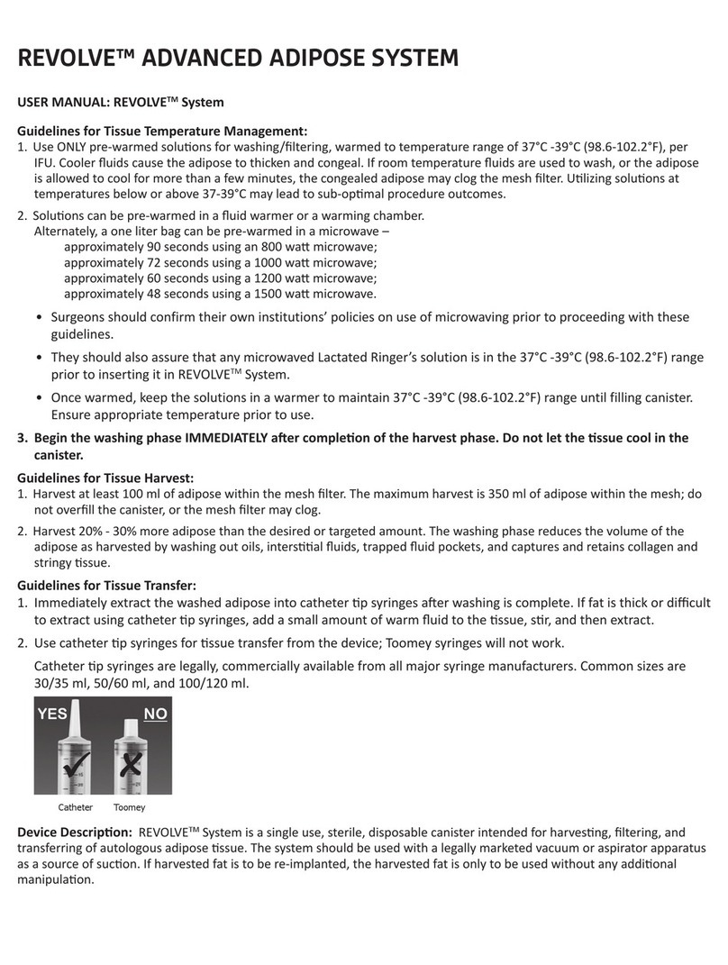 Allergan REVOLVE System User manual