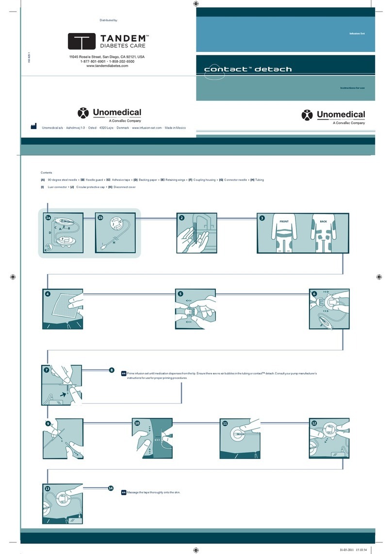 Unomedical Contact Detach Instructions for use Unomedical Contact Detach Instructions for use