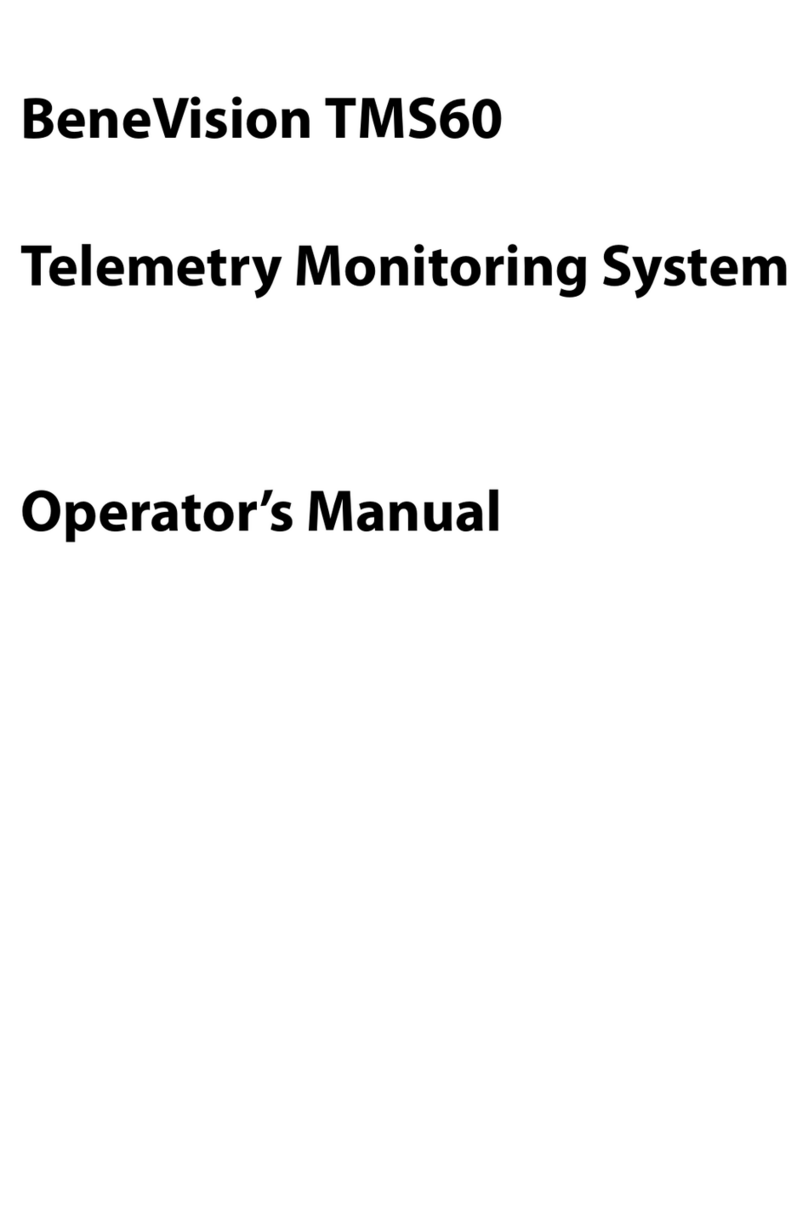 Mindray BeneVision TMS60 User manual