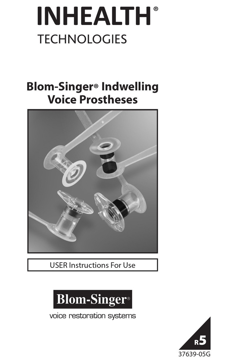 inhealth Blom-Singer Instructions for use