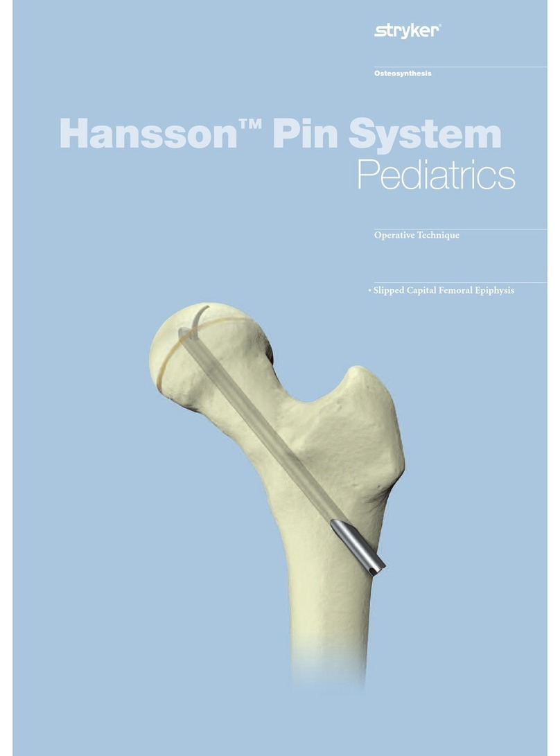 Stryker Hansson Pin System manual