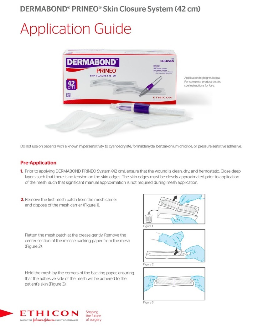 Ethicon DERMABOND PRINEO User guide
