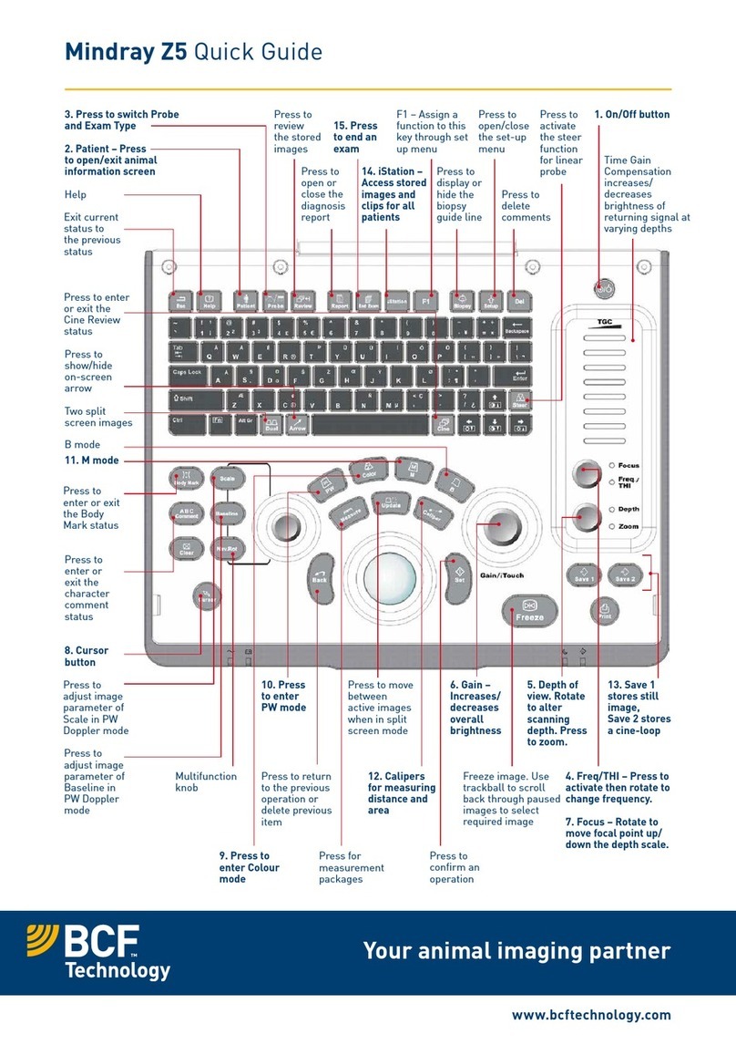 BCF Technology Mindray Z5 quick guide