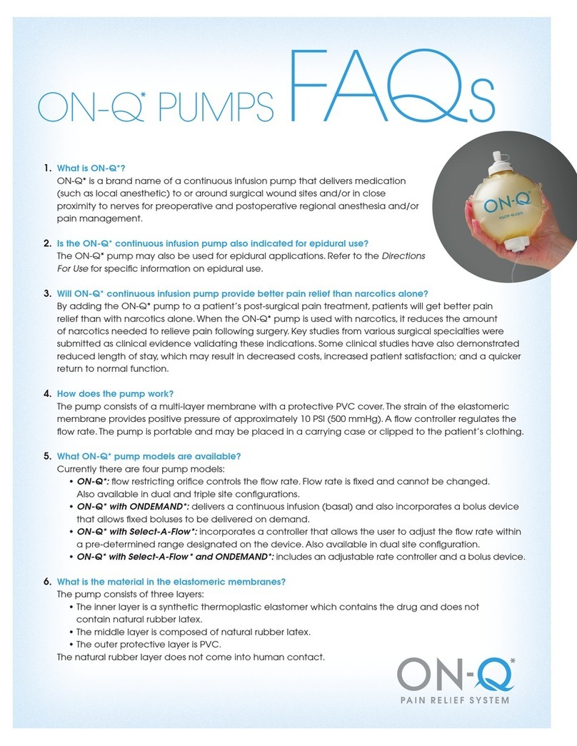 iFlow On-Q Series Faqs