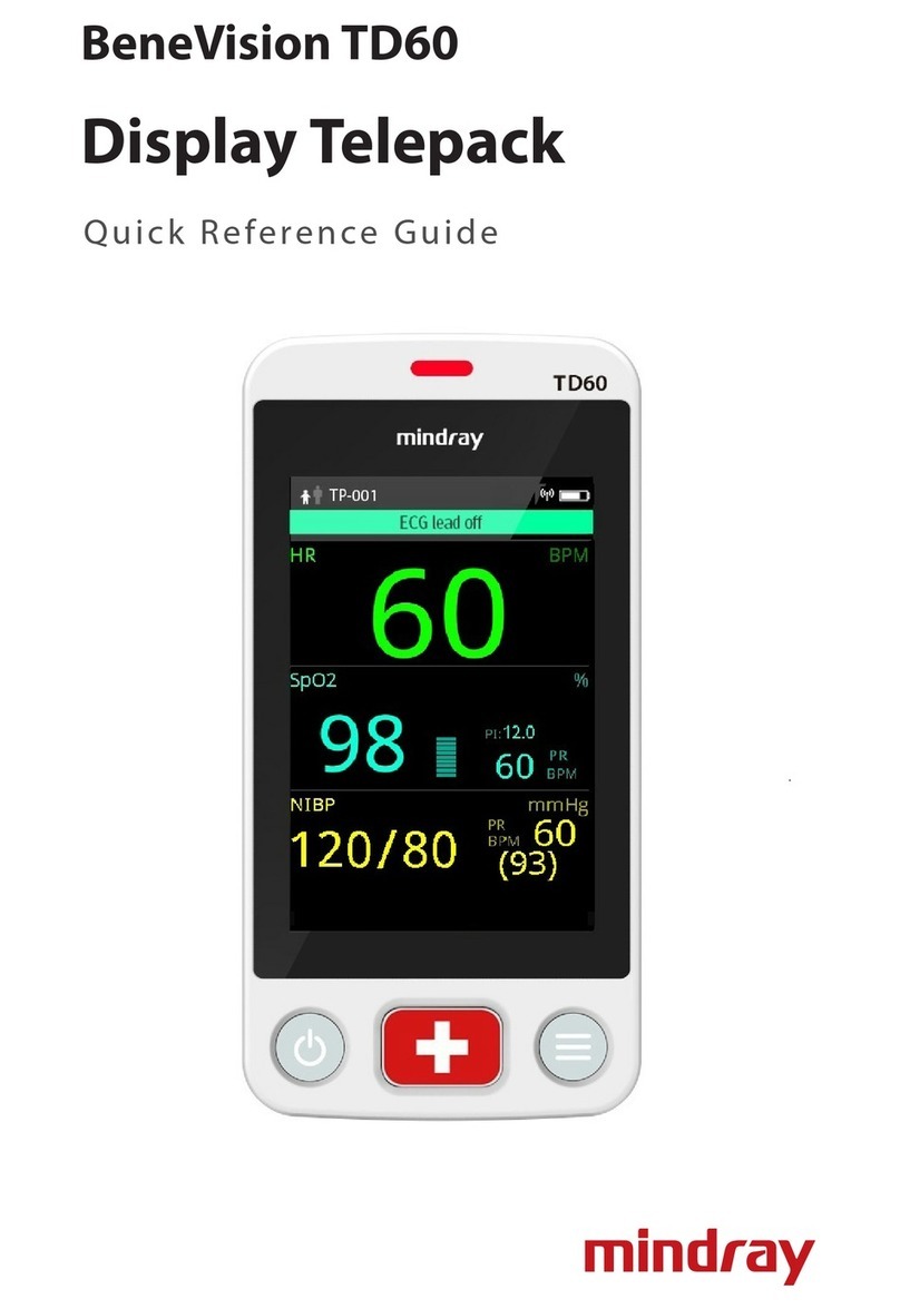 Mindray BeneVision TD60 User manual