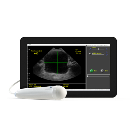 INTERSON ViewBladder 10 user guide