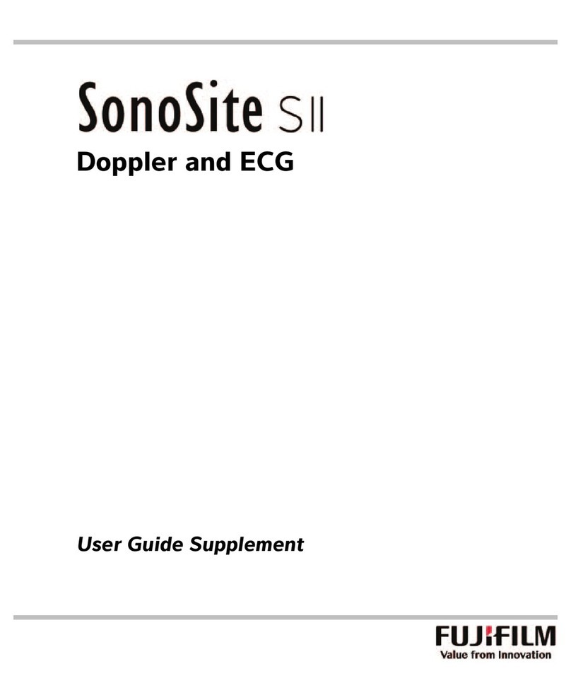 FujiFilm SonoSite SII User guide supplement FujiFilm SonoSite SII User guide supplement