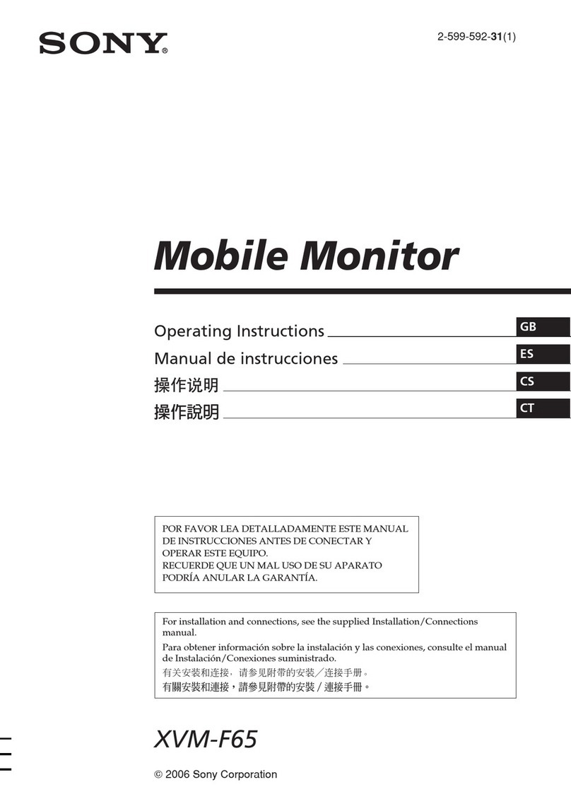 Sony XVM-F65 operating instructions