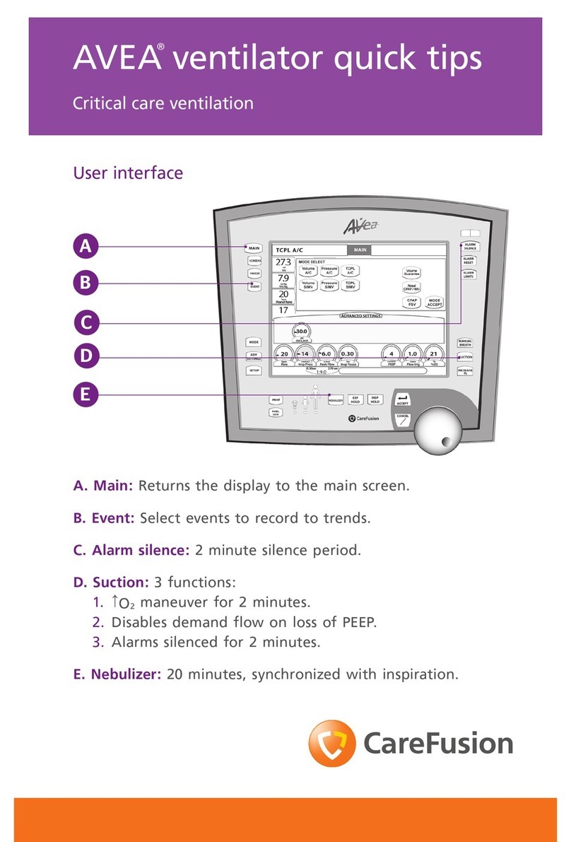 Care Fusion AVEA Quick tips