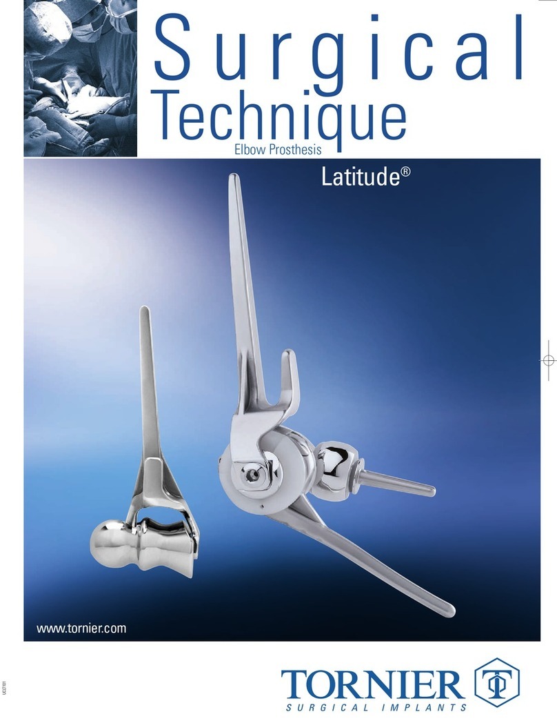 Tornier Latitude manual
