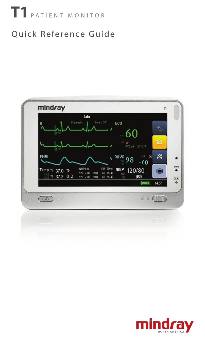 Mindray BeneView T1 Quick reference guide