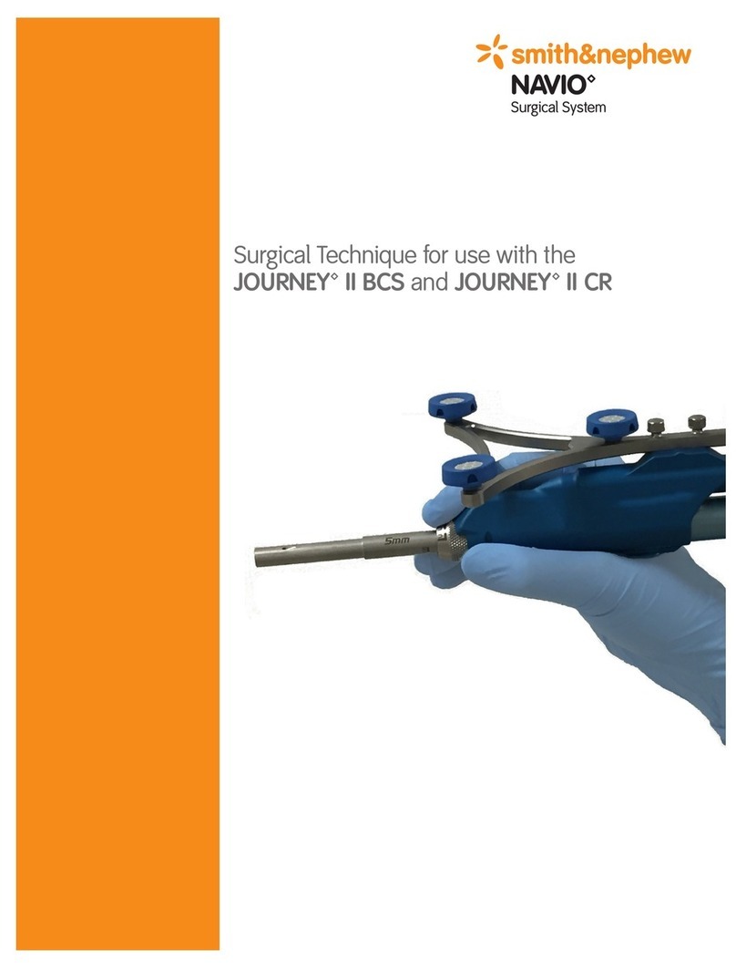 Smith & Nephew JOURNEY II BCS manual