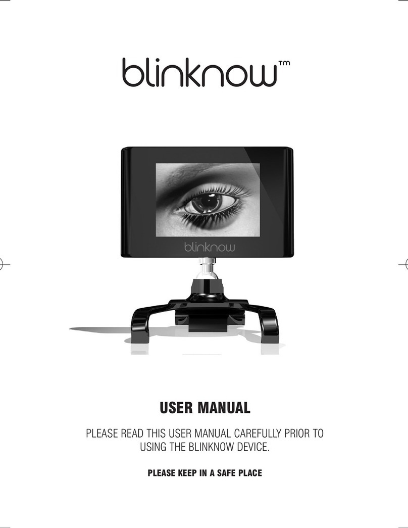Blaze Device user manual