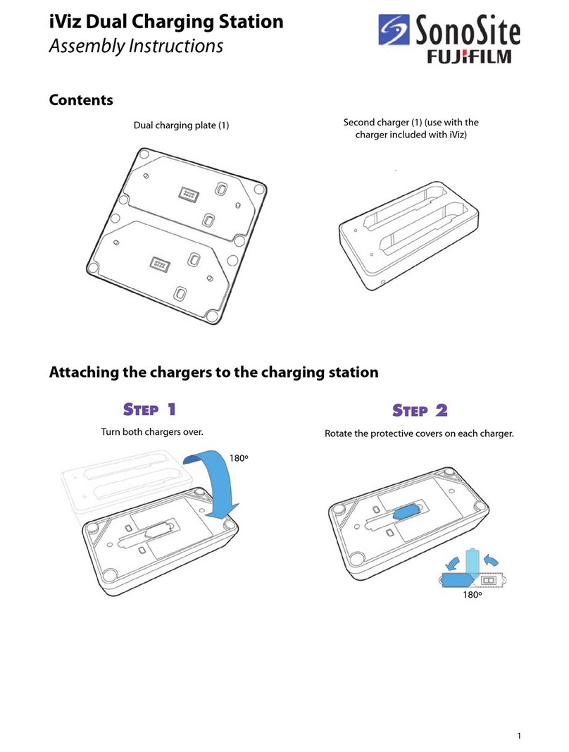 SonoSite iViz Assembly instructions