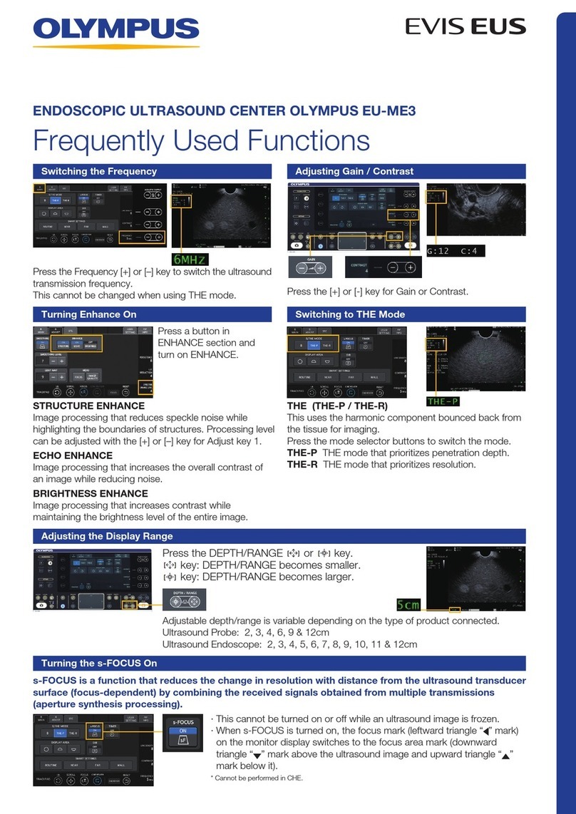 Olympus EVIS EUS EU-ME3 quick start guide Olympus EVIS EUS EU-ME3 quick start guide