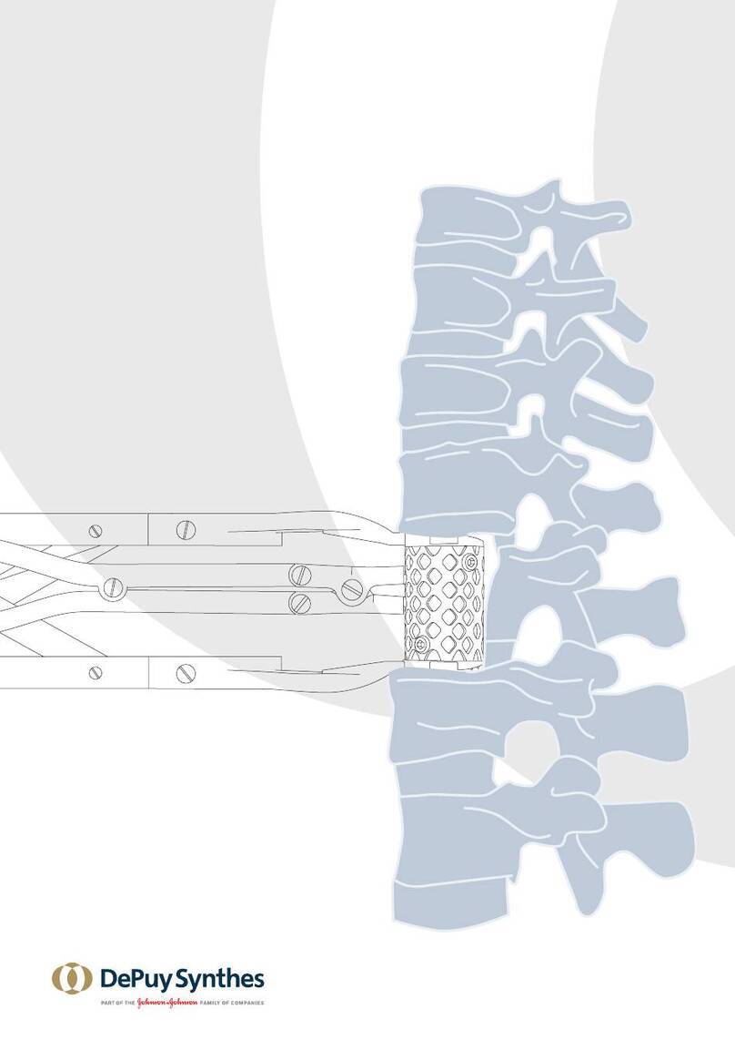 Synthes SYNMESH SURGICAL TECHNIQUE