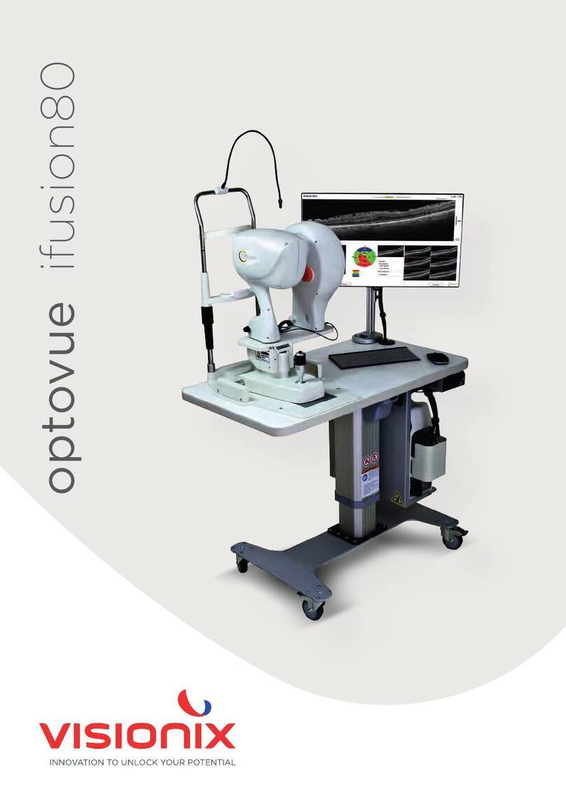 Visionix optovue ifusion80 user manual