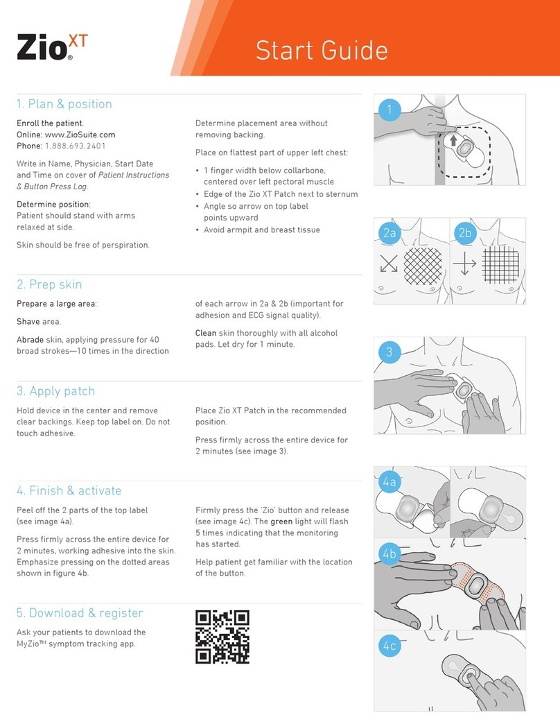 Zio XT Start guide