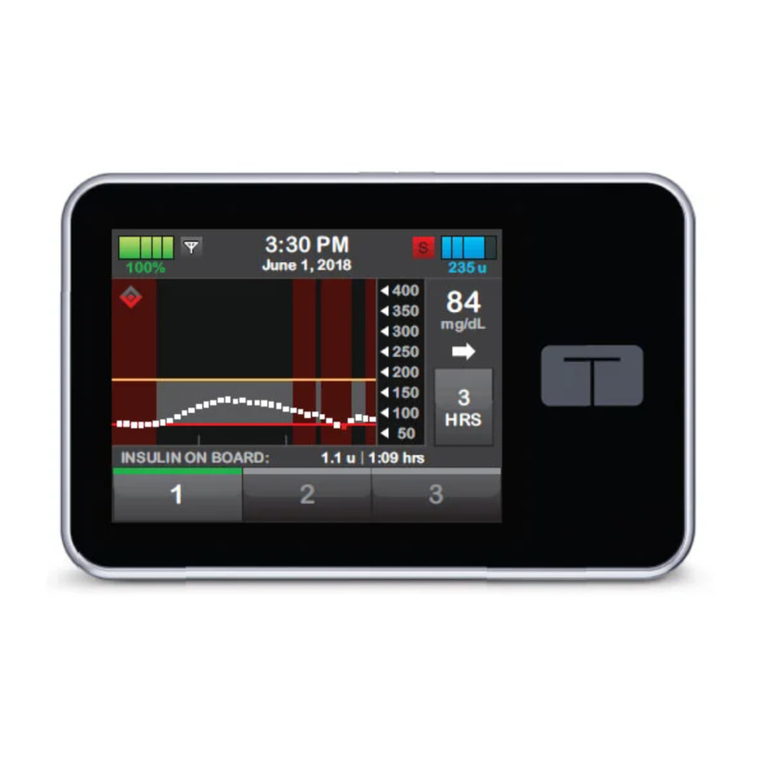 Tandem t:slim X2 Installation guide