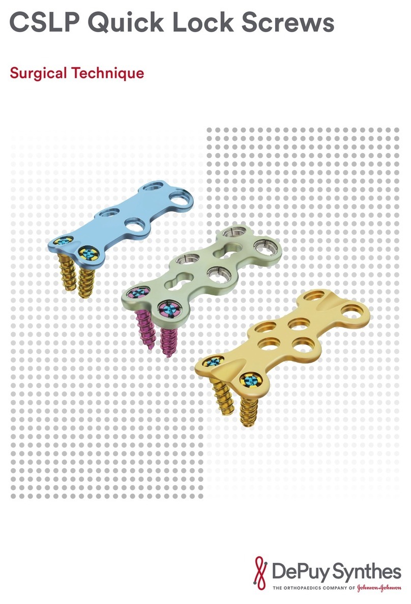 Johnson & Johnson DePuy Synthes CSLP manual