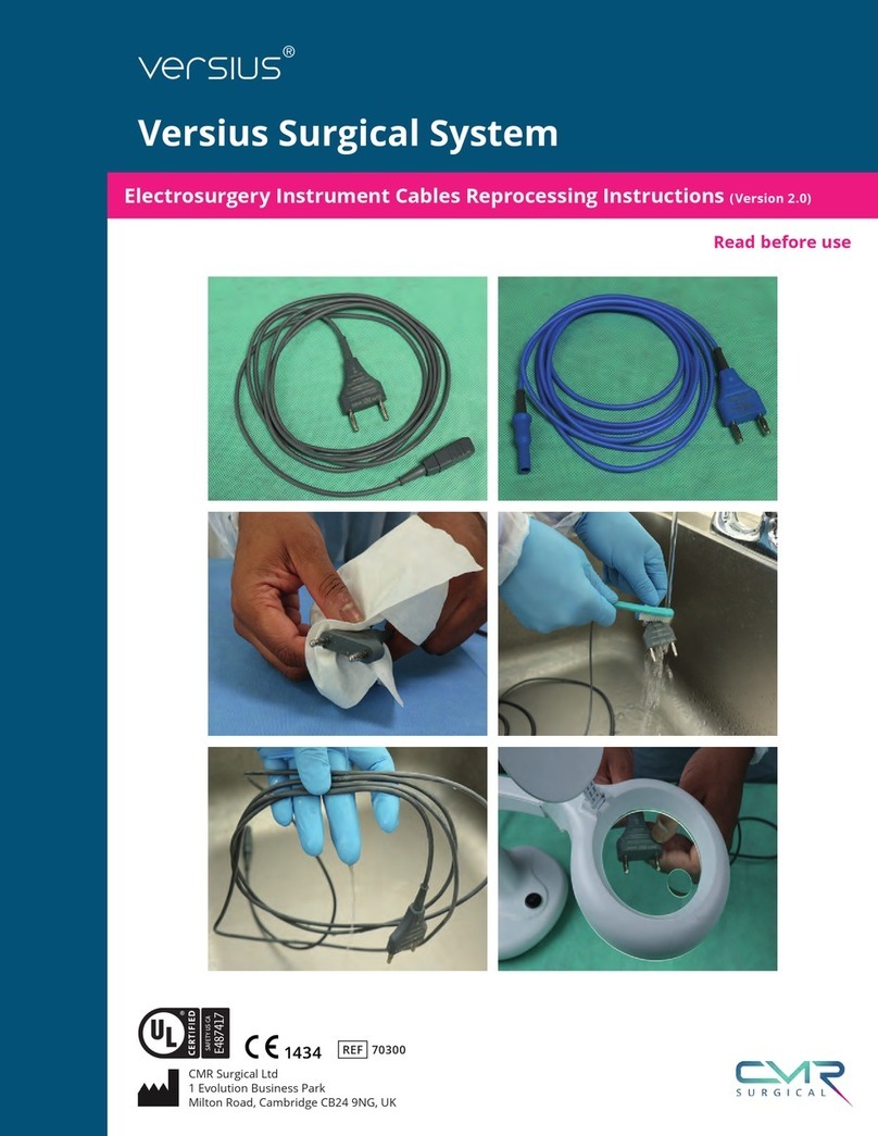 CMR versius manual