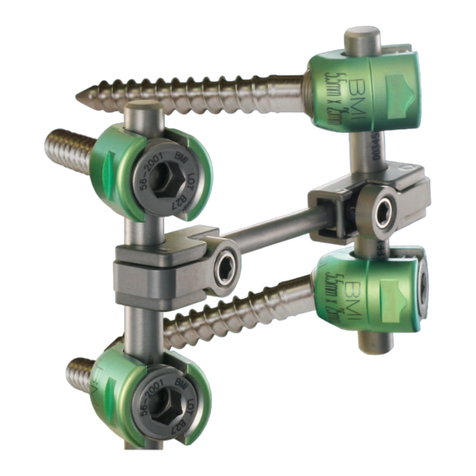 Orthofix SFS manual