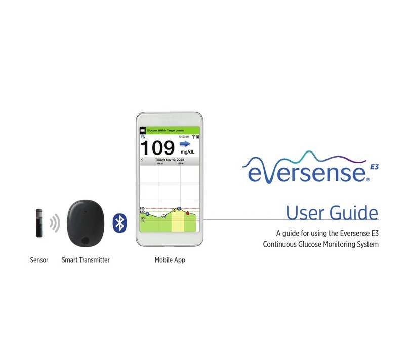 eversense E3 user guide