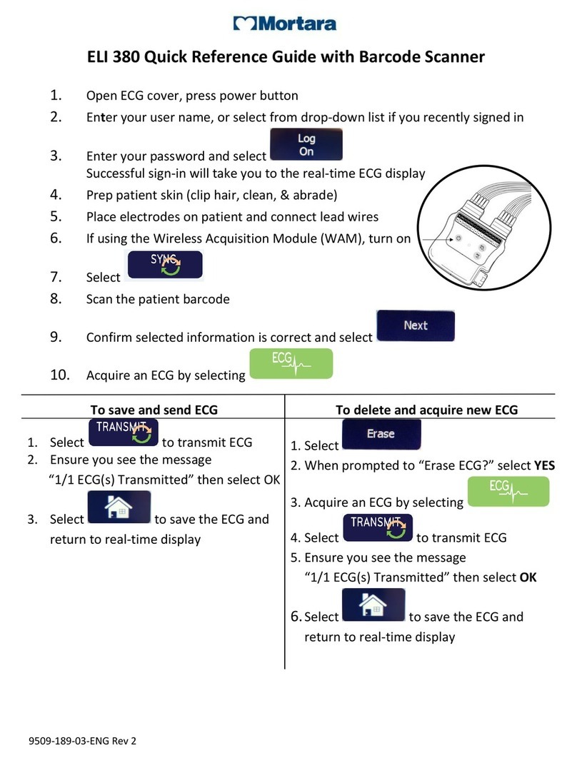 Mortara ELI 380 Quick reference guide