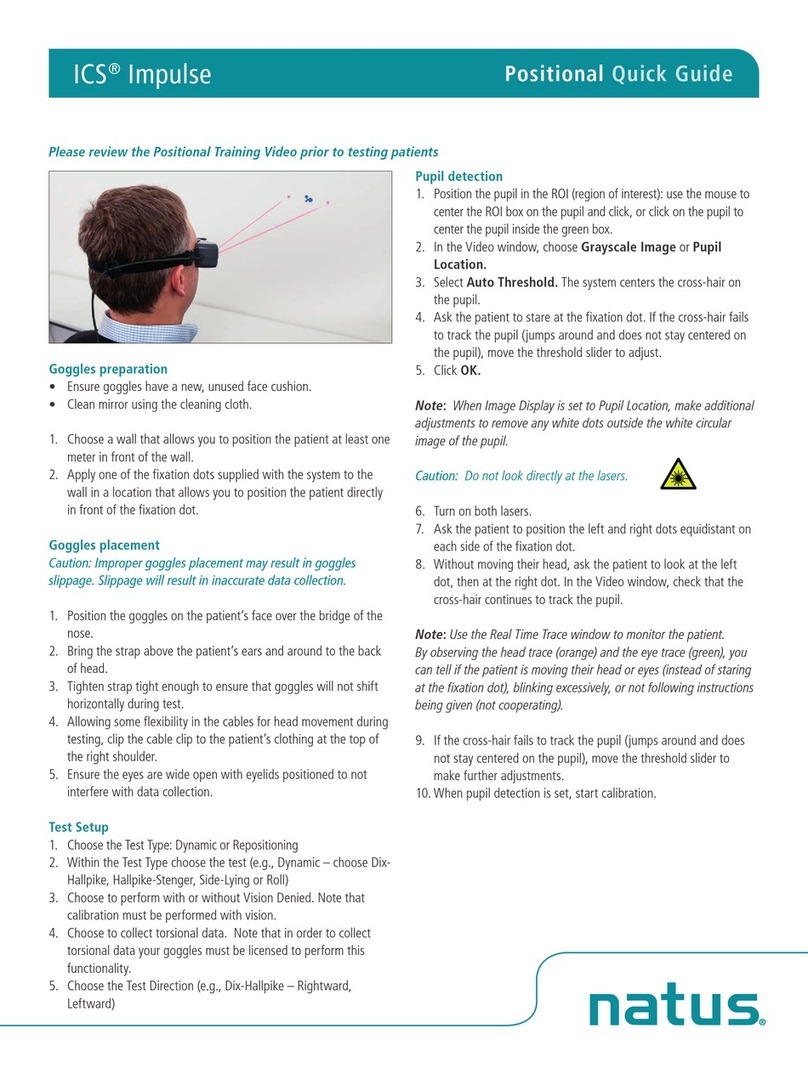 natus ICS Impulse User manual