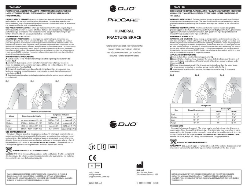 DJO PROCARE 330-40-1111 quick start guide