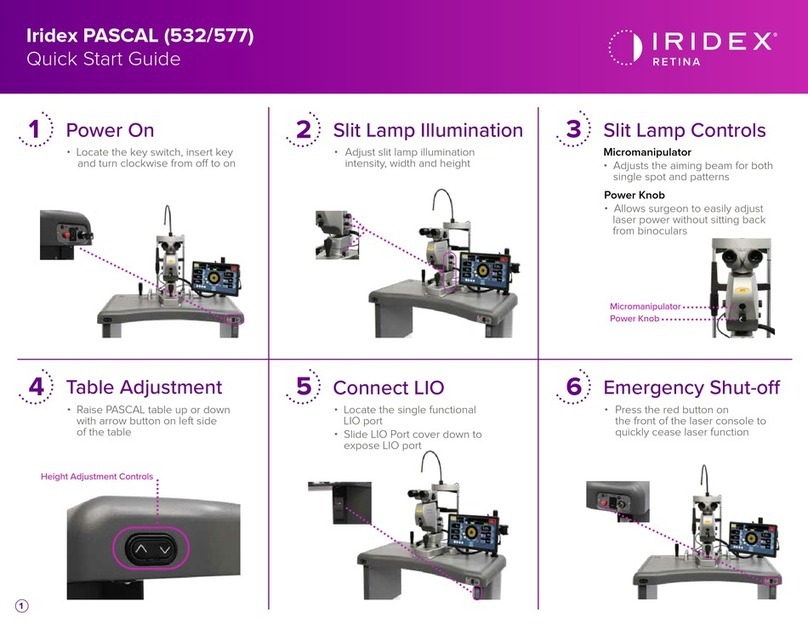 Iridex PASCAL quick start guide Iridex PASCAL quick start guide