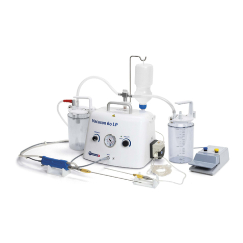 Nouvag Vacuson 60 LP Operation manual Nouvag Vacuson 60 LP Operation manual